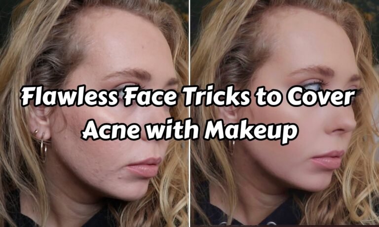Flawless Face Tricks to Cover Acne with Makeup That Actually Works
